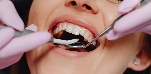 Preventive Care A dental professional performing a dental cleaning