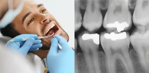 Preventive Care Side-by-side view showing a clinical dental exam and a dental X-ray.